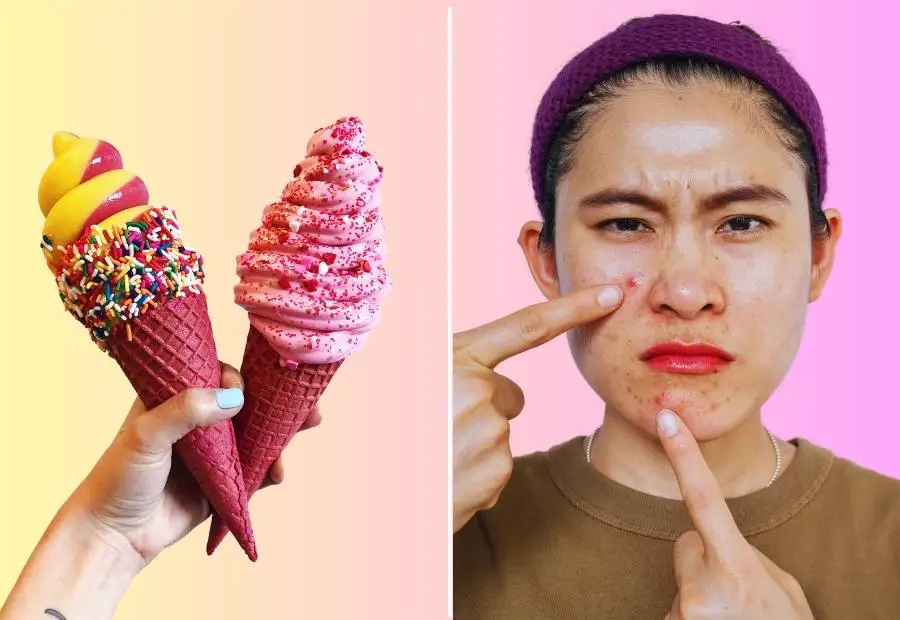 can-ice-cream-cause-acne-fact-or-fiction